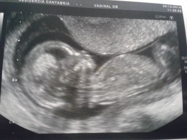 Super mamás julio 2015!! :) - 2