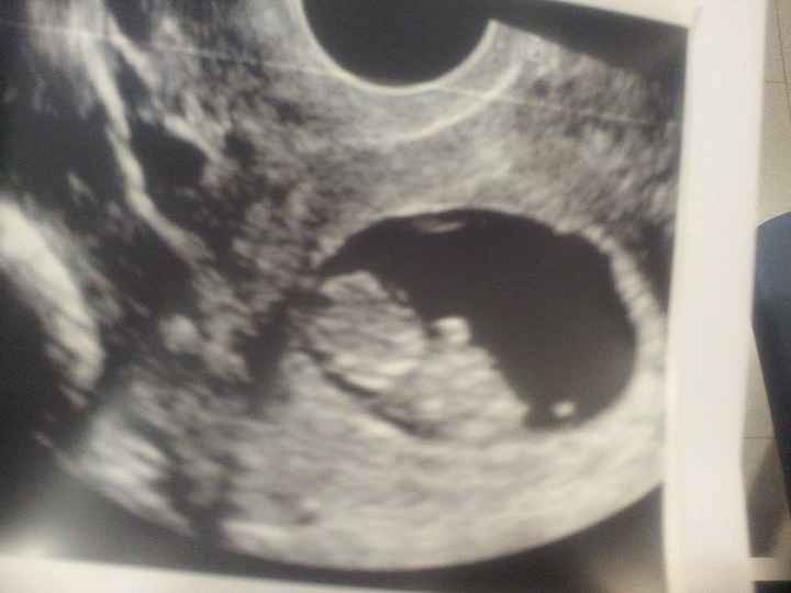 9 Semanas