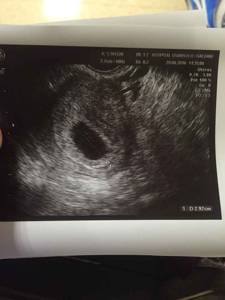 Futuras mamás marzo 2017 - 1