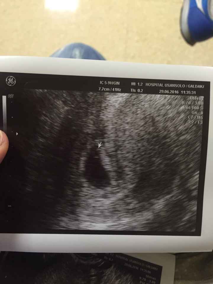 Futuras mamás marzo 2017 - 2
