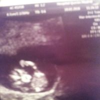 Futuras mamás Octubre 2018!!! - 1