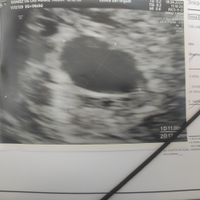 Futuras Mamás Noviembre y Diciembre - 1