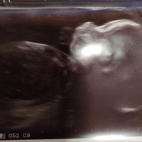 Futuras mamás Octubre 2018!!! - 1