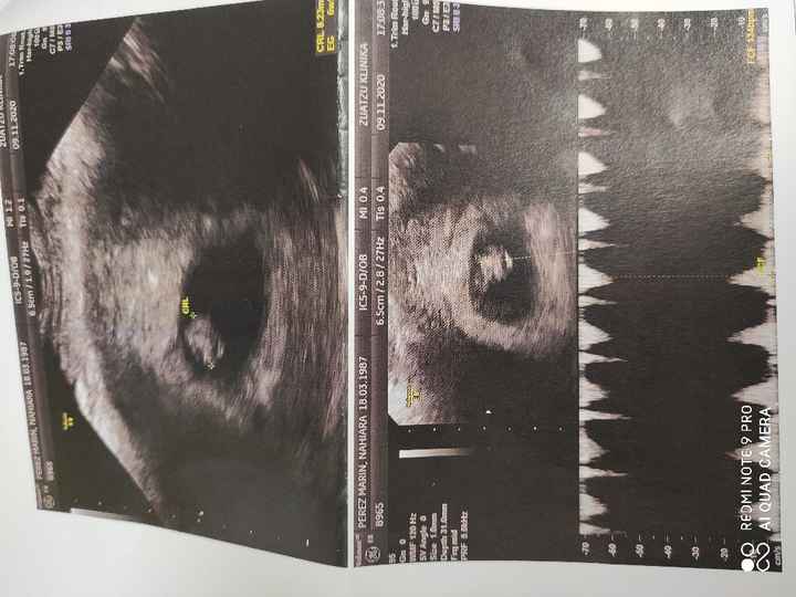 Futuras mamis junio 2021 🤰🏻❤️ oficial - 1