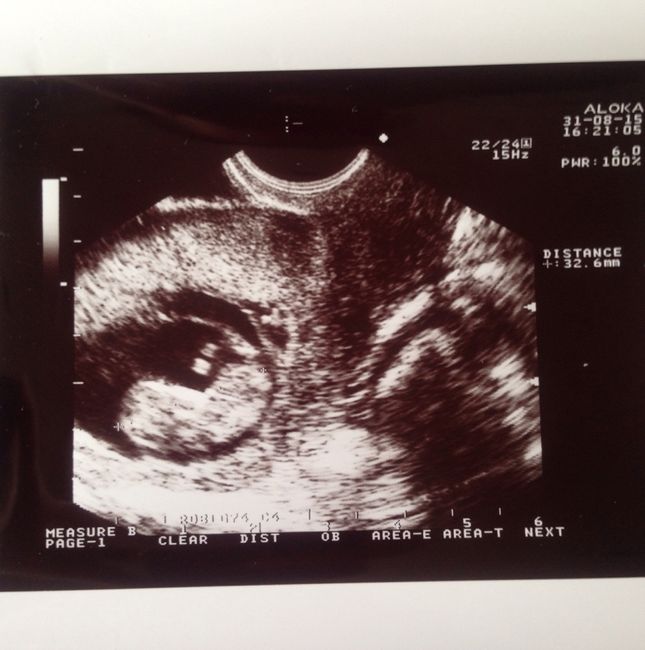 Mamis marzo 2016 - 1