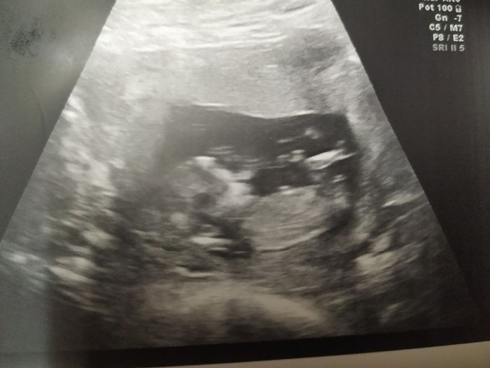 Mamis mayo 2020 - 1