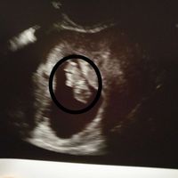 Semana 9