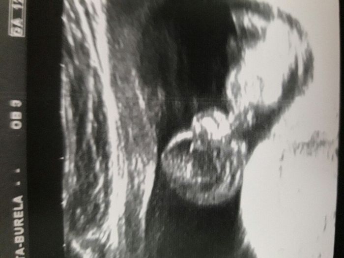 Futuras mamás abril 2017 - 1