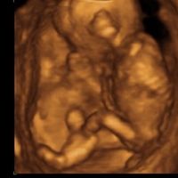 Mamas Noviembre 2014 - 1