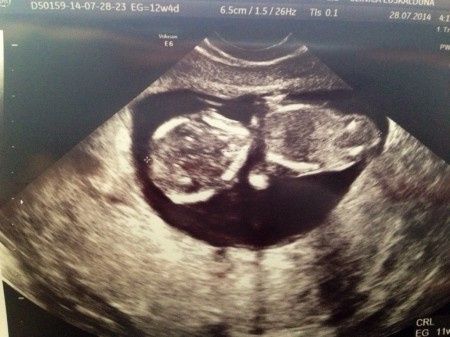 Mamas Febrero 2015 - 1
