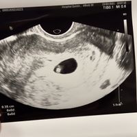 Futuras mamás octubre 2021 - 1