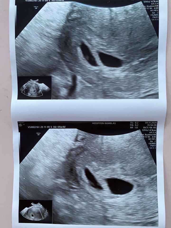 Futuras mamás julio 2021🤰🌹😍😍 - 1