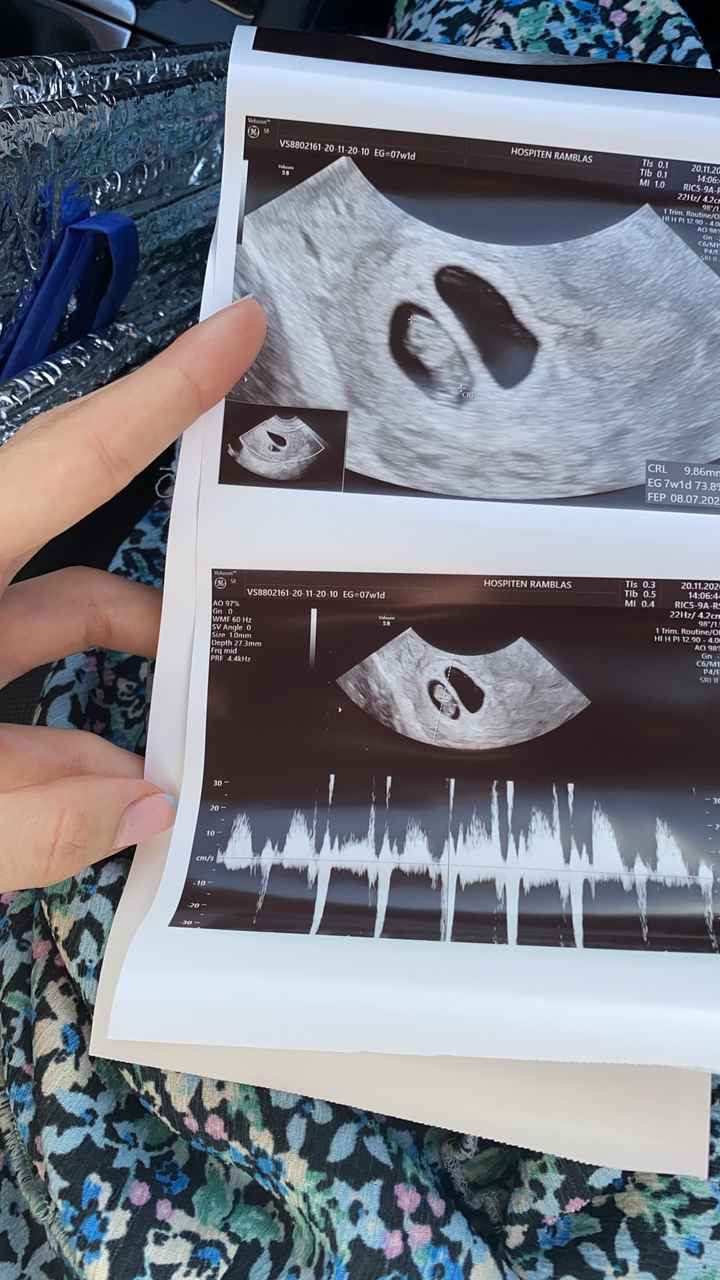 Futuras mamás julio 2021🤰🌹😍😍 - 1