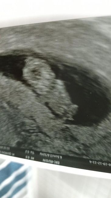 Futuras Mamas Julio 2020. - 1