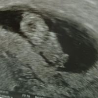 Futuras Mamas Julio 2020. - 1