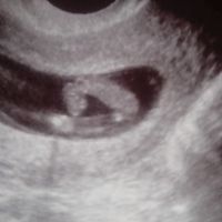 mi peque 2