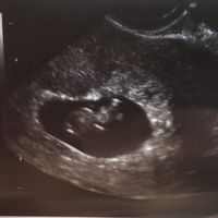 Futuras mamas septiembre 2021🤰🤱 - 1