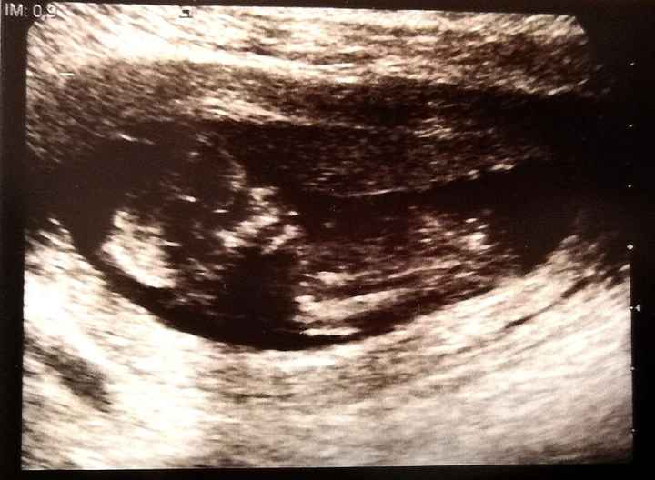 Futuras mamás Septiembre 2020 - 1