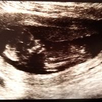 Futuras mamás Septiembre 2020 - 1