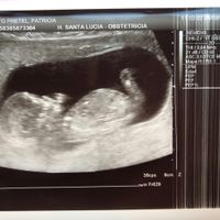 Tubérculo genital niño o niña??? - 1