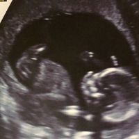 Futuras mamás septiembre 2019 - 2