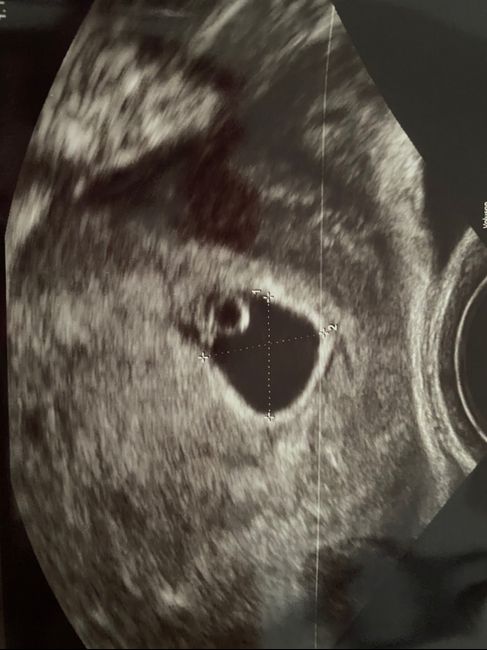 Futuras mamas Diciembre 2020 - 1