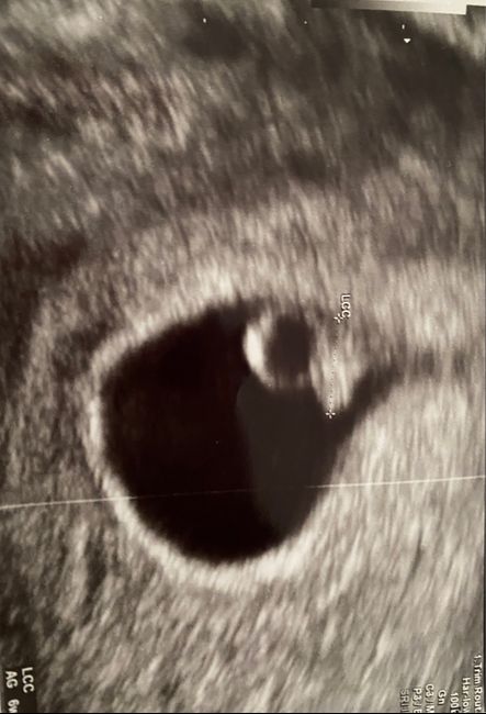 Futuras mamas Diciembre 2020 - 2
