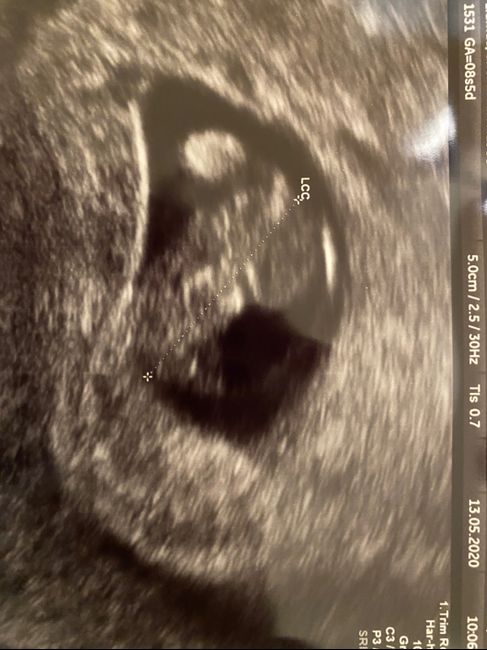 Futuras mamas Diciembre 2020 - 1