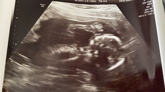 Futuras mamas Diciembre 2020 - 1