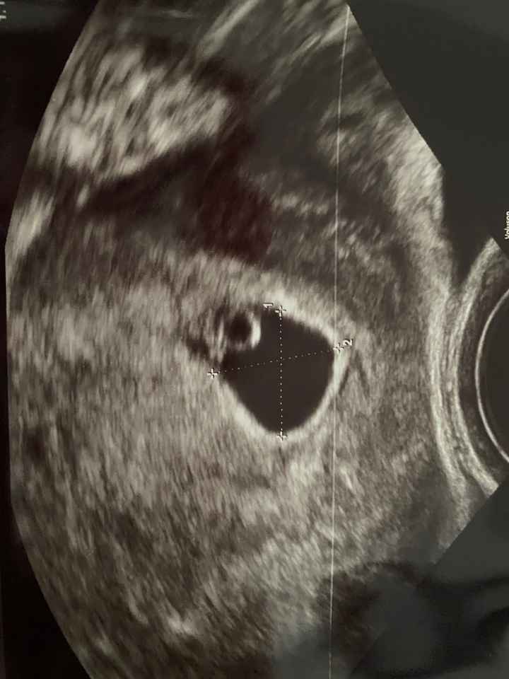 Futuras mamas Diciembre 2020 - 1