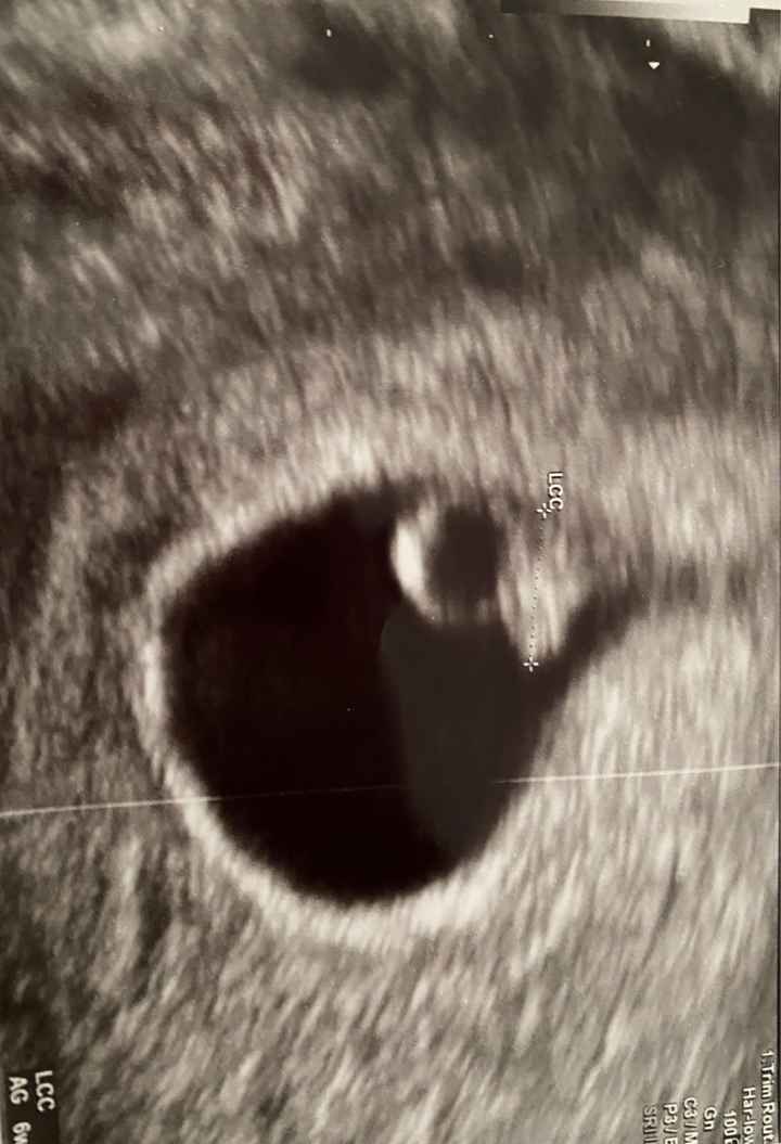 Futuras mamas Diciembre 2020 - 2