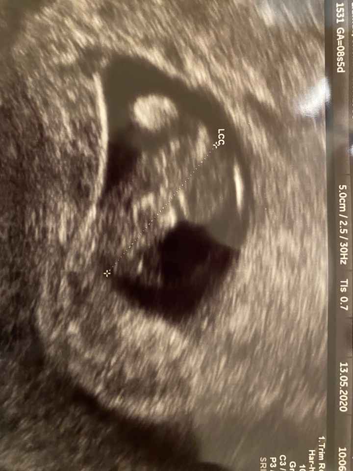 Futuras mamas Diciembre 2020 - 1