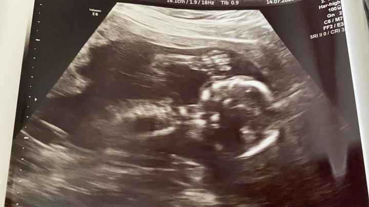 Futuras mamas Diciembre 2020 - 1