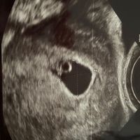 Futuras mamas Diciembre 2020 - 1