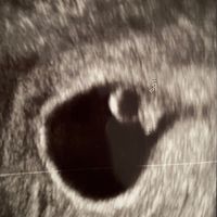 Futuras mamas Diciembre 2020 - 2