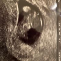Futuras mamas Diciembre 2020 - 1