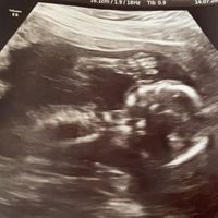 Futuras mamas Diciembre 2020 - 1
