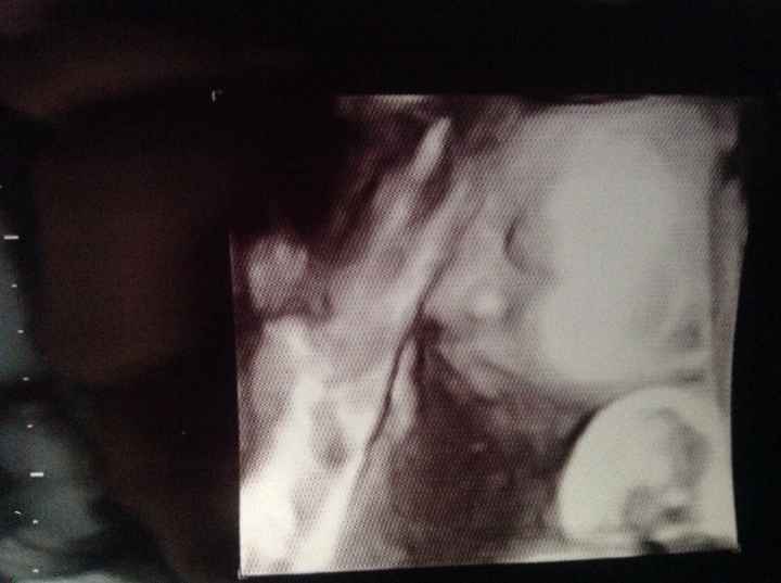 Semana 33