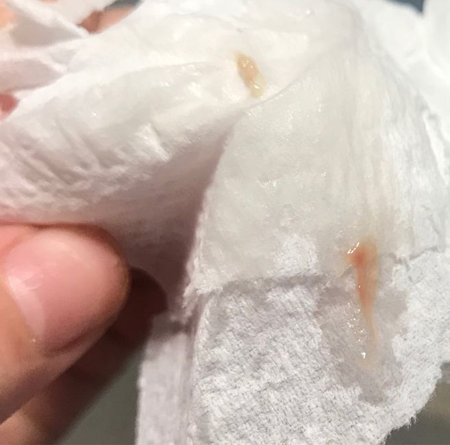 Sangrado de implantación, cuando da positivo? 2