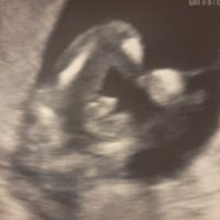 Niño o niña - 1