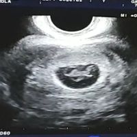 Semana 7+5