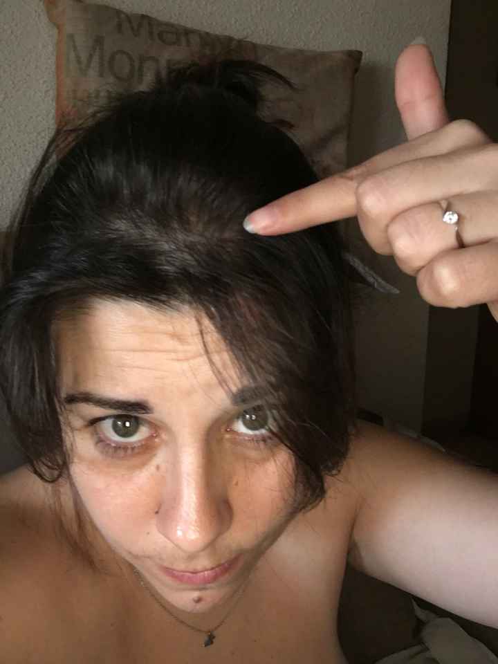 Tengo escasez de pelo y muy fino - 1