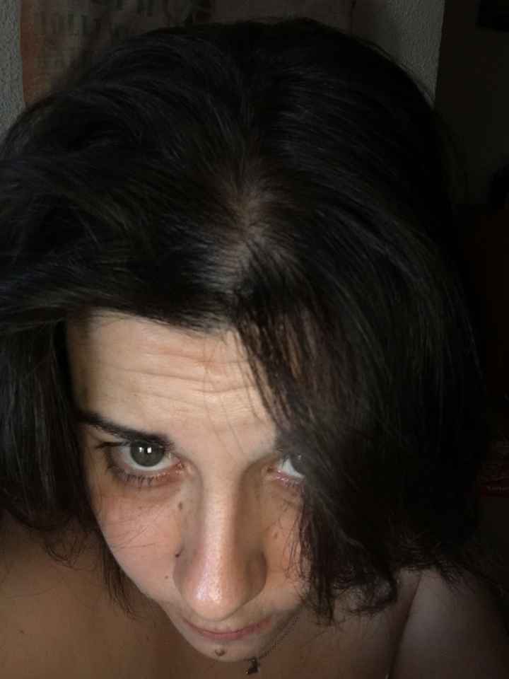 Tengo escasez de pelo y muy fino - 2