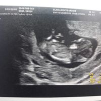 Ayuda con método ramzi: niño o niña? - 1