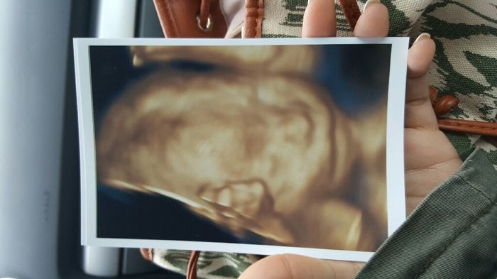 Futuras mamas septiembre 2016 - 1