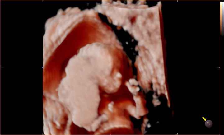 Futuras mamas octubre 2020 - 3