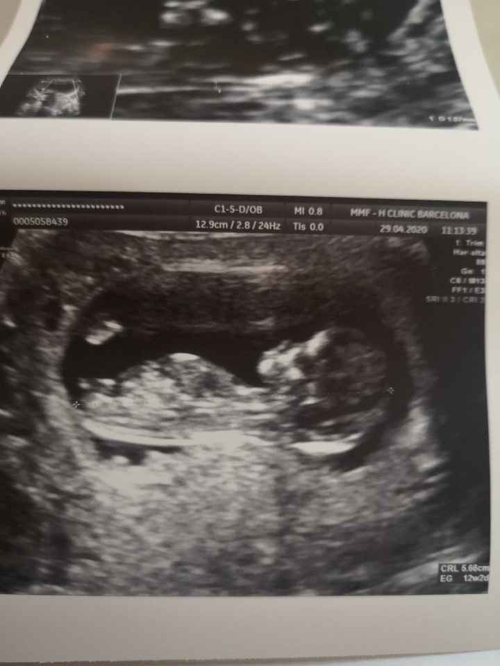 Futuras mamas noviembre 2020 - 1