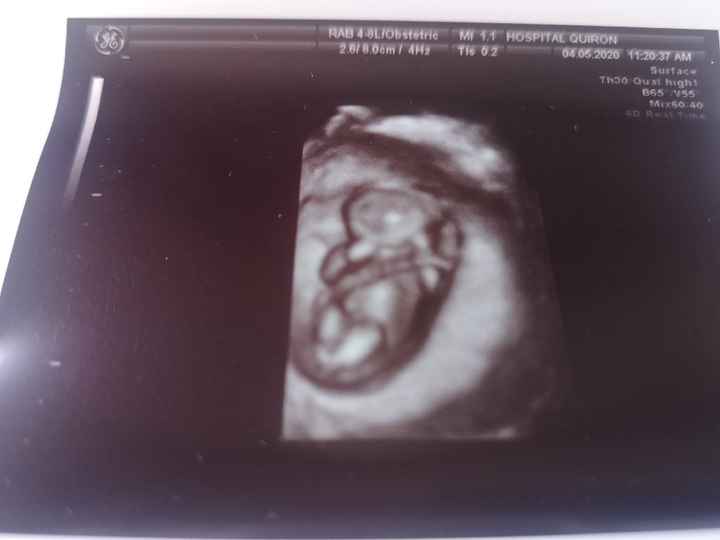 Futuras mamas noviembre 2020 - 1