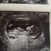Futuras mamas noviembre 2020 - 1