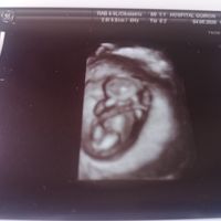 Futuras mamas noviembre 2020 - 1